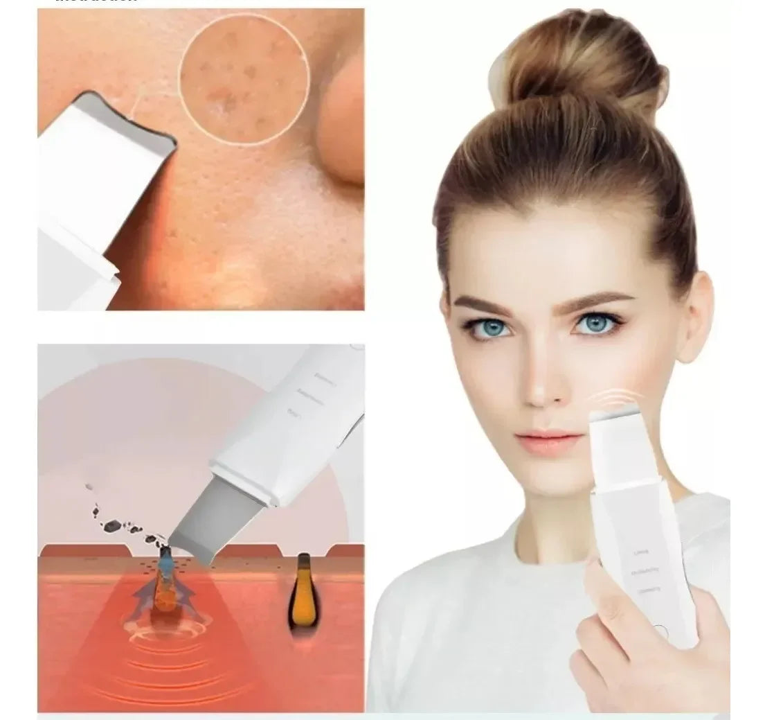 UltraSkin™ - Limpieza ultrasónica profunda y renovación de tu piel