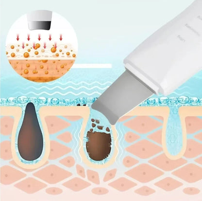 UltraSkin™ - Limpieza ultrasónica profunda y renovación de tu piel